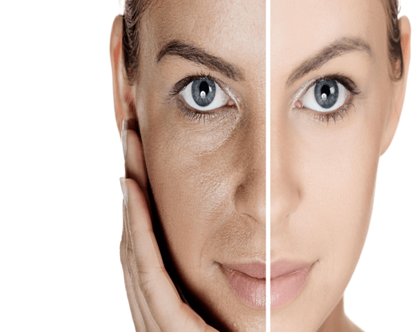 zavrashtaneto-na-so2-lazera-zashto-tezi-lazeri-ot-sledvashto-pokolenie-otnovo-sa-tuk