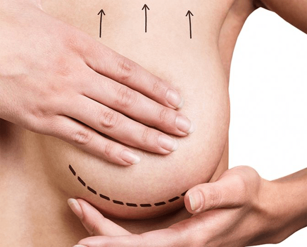 povdigane-na-gardite