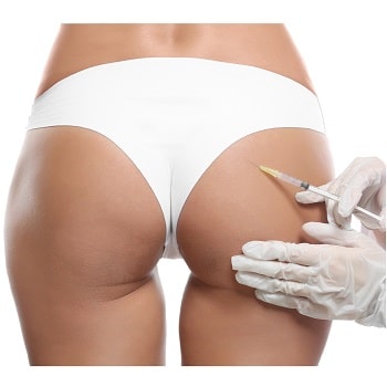 neoperativno-povdigane-na-dupeto