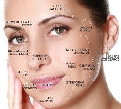 injektirane-na-filar-juvéderm