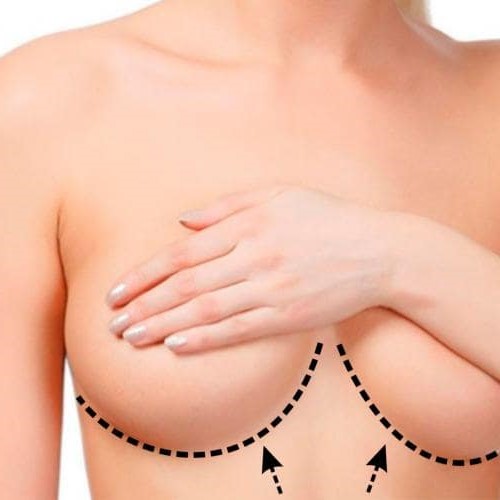 lipofiling-gardi-uvelichavane-na-byusta-sas-sobstveni-maznini